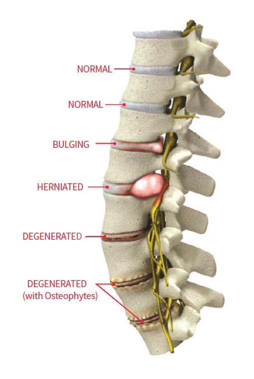 common conditions treated by DISCSEEL